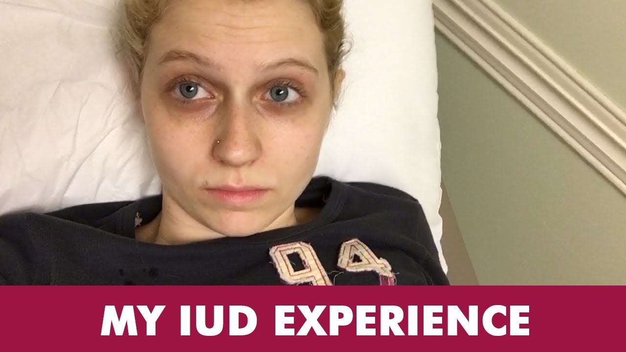 My IUD Experience