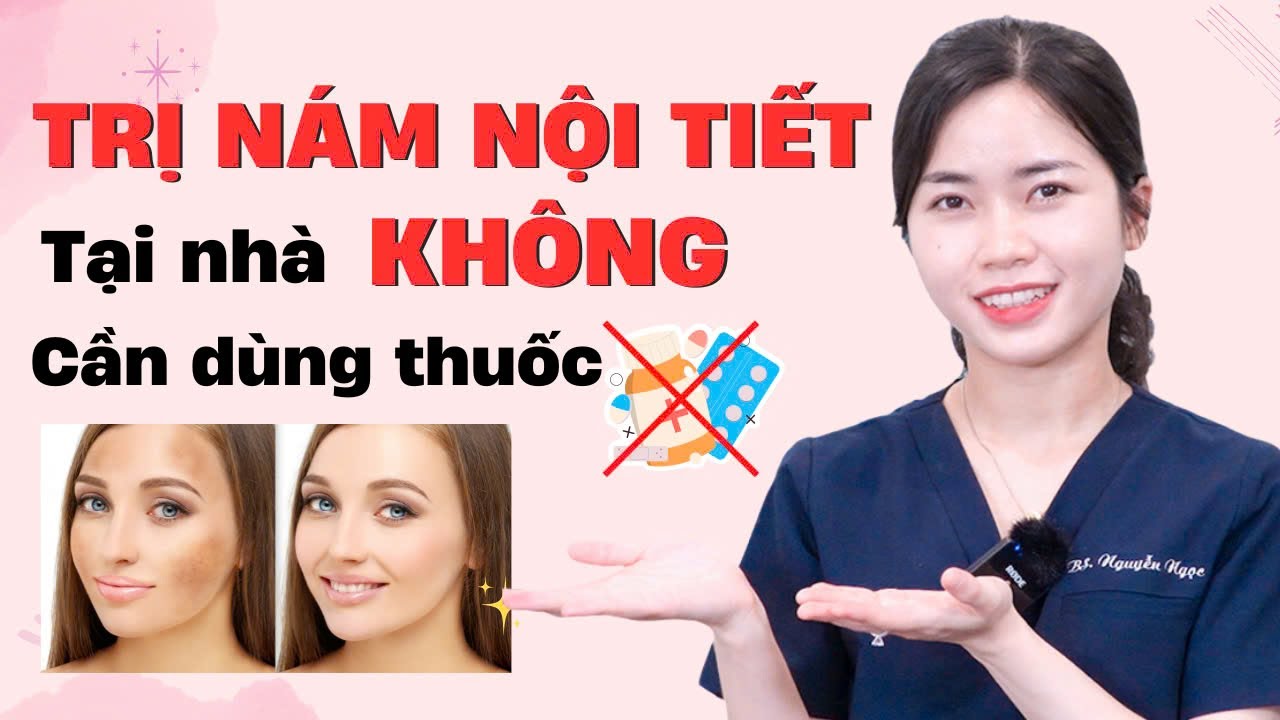 Cách trị nám nội tiết tại nhà không cần dùng thuốc - Nám da do nội tiết|Bs Nguyễn Ngọc