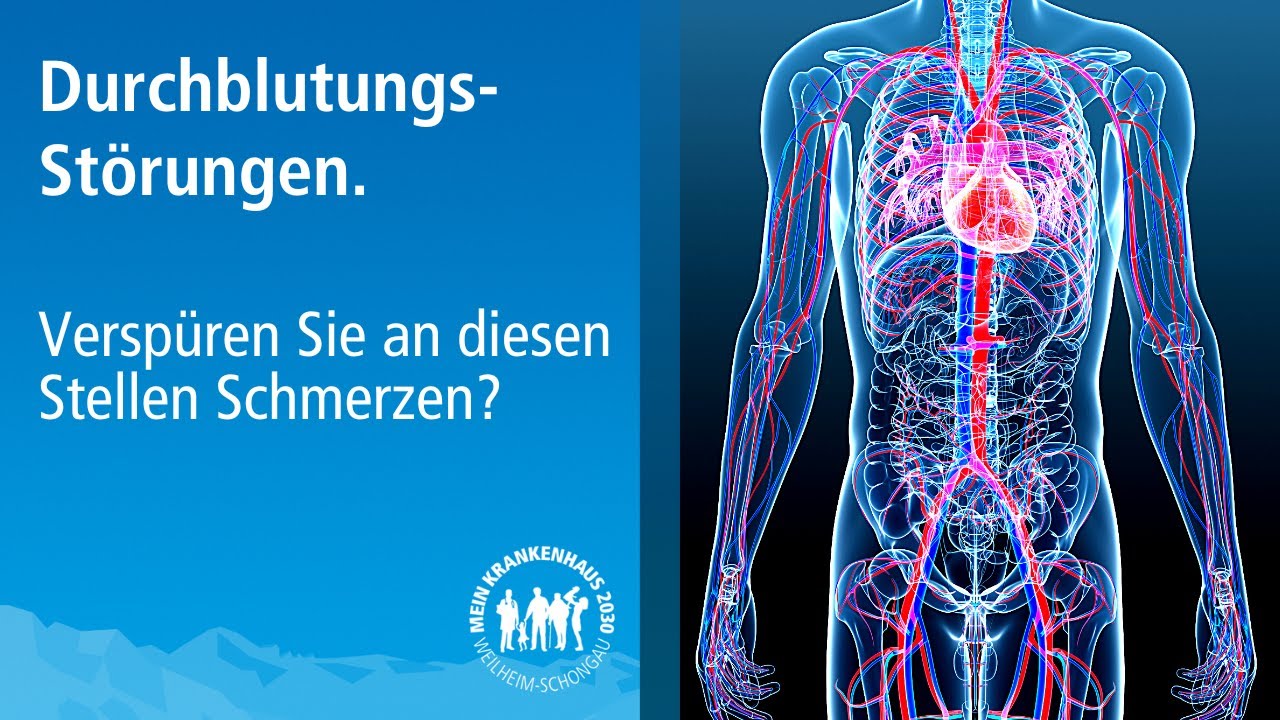 Durchblutungsstörungen erkennen und richtig behandeln