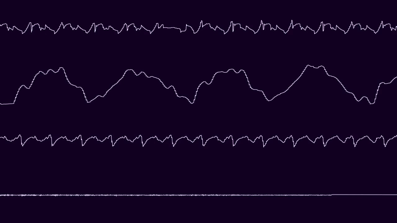 Jesper Kyd - Global Trash 3 v2 (Amiga) (Oscilloscope view)