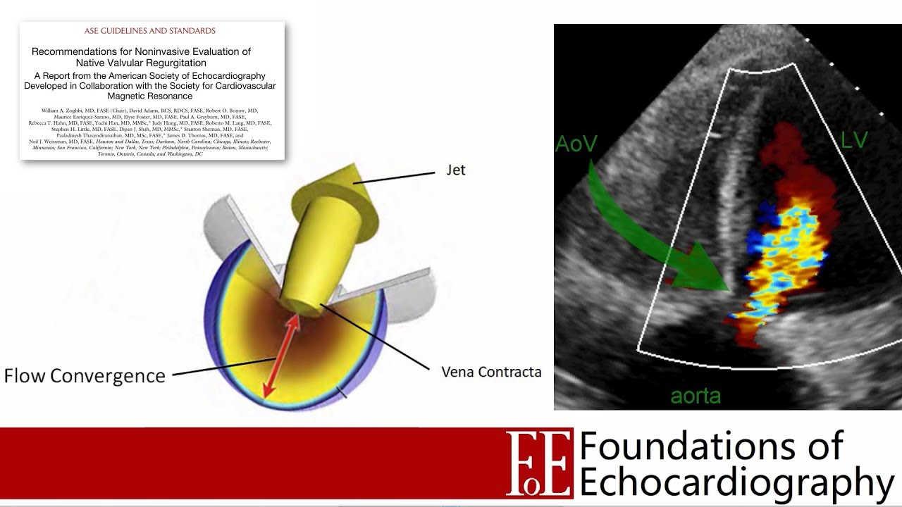Level 1 Video Lecture: Valvulopathies