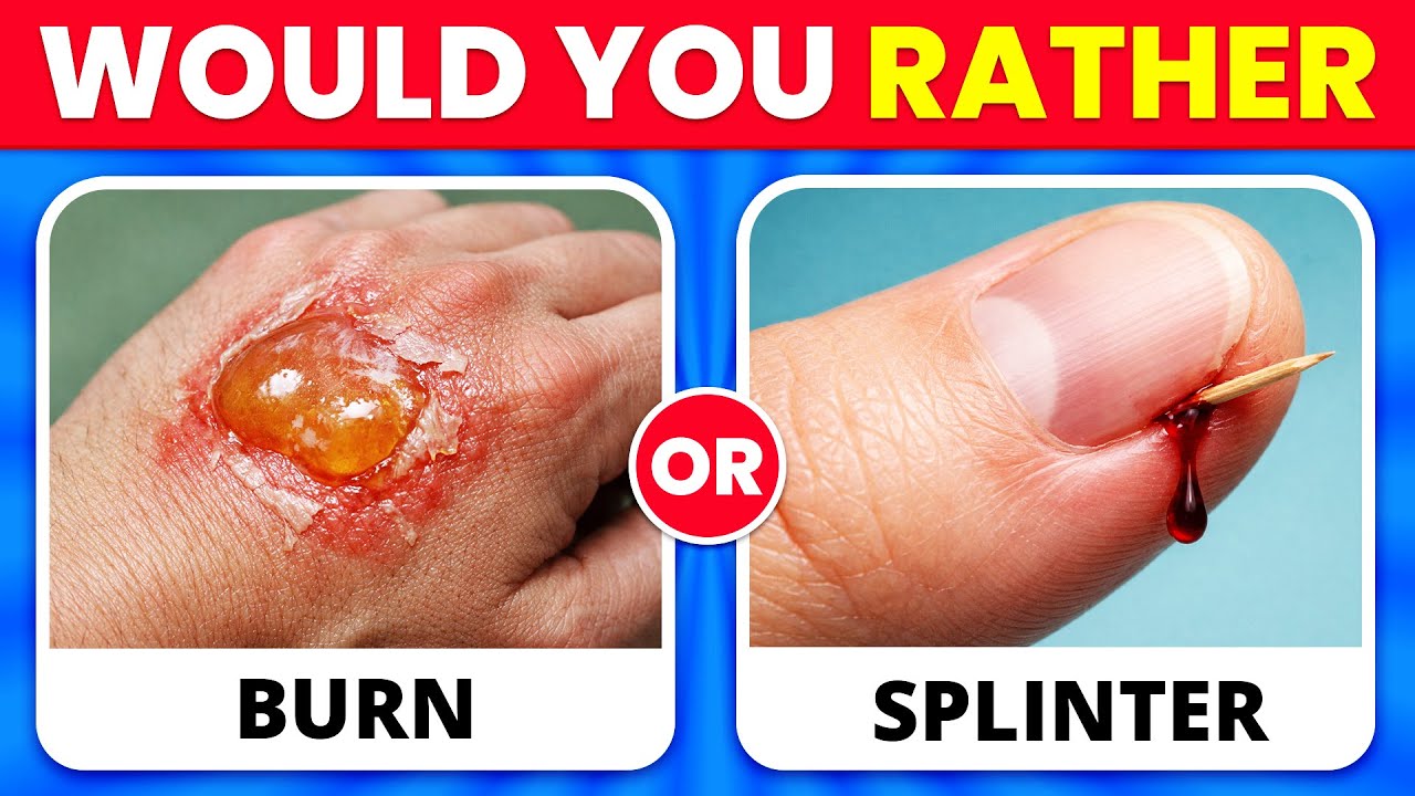 Would You Rather&hellip;? 😨 The Most Extreme Choices EVER | Easy to IMPOSSIBLE