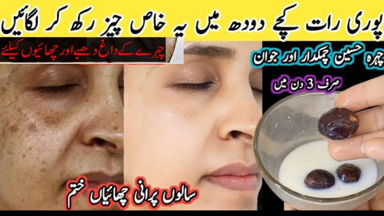 Hyperpigmentation, Scars & Dark Spots Removal Nutmeg/Jaiphal Face Pack /SairaAli