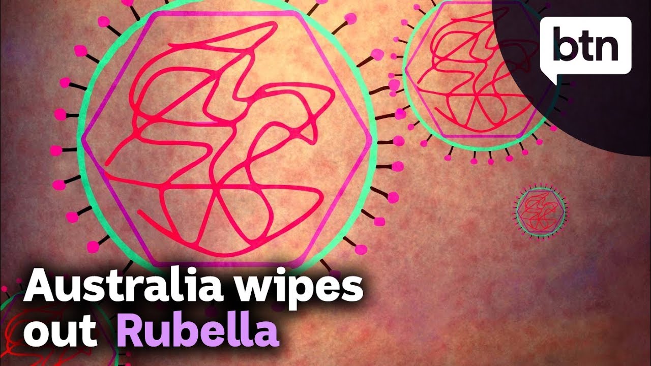 Vaccinations Successfully Wipe Out Rubella Virus in Australia