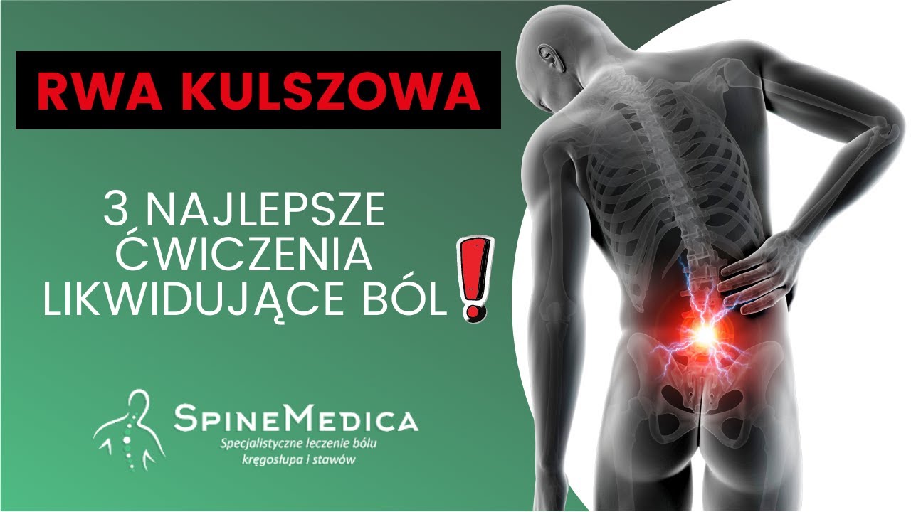 Rwa kulszowa ćwiczenia - 3 Sprawdzone sposoby
