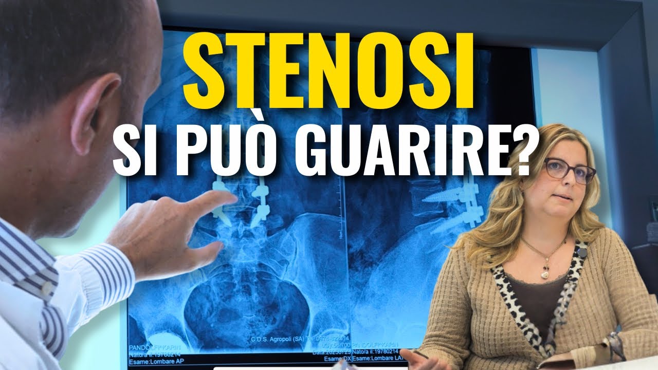 STENOSI: Caso complesso dalla diagnosi al recupero completo 