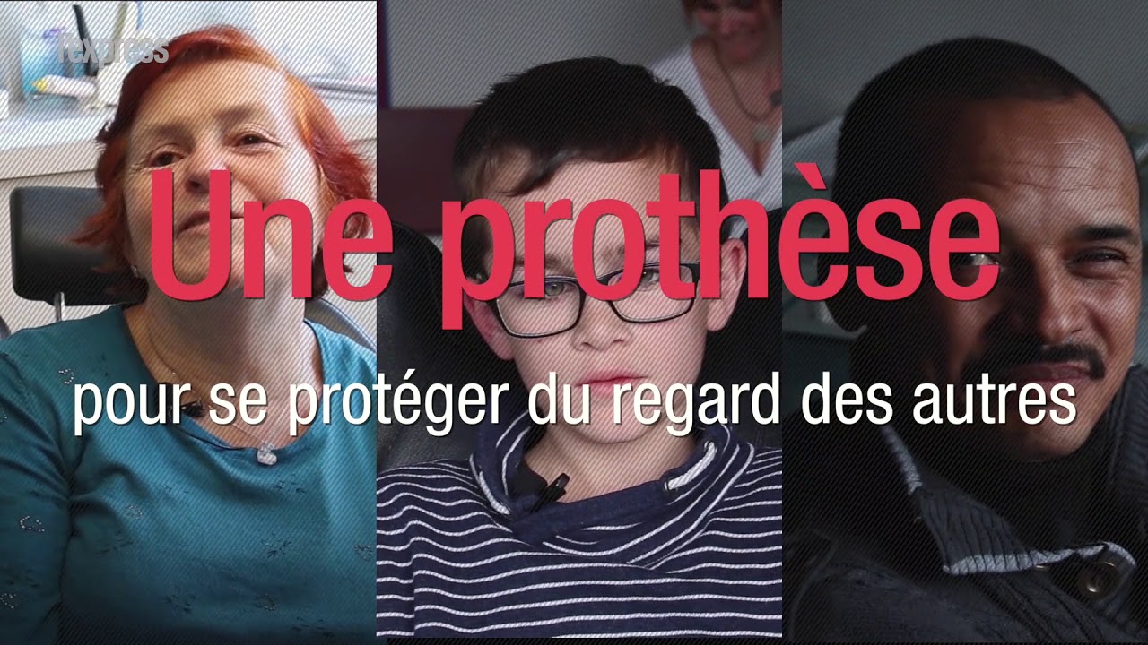 Porter une prothèse oculaire