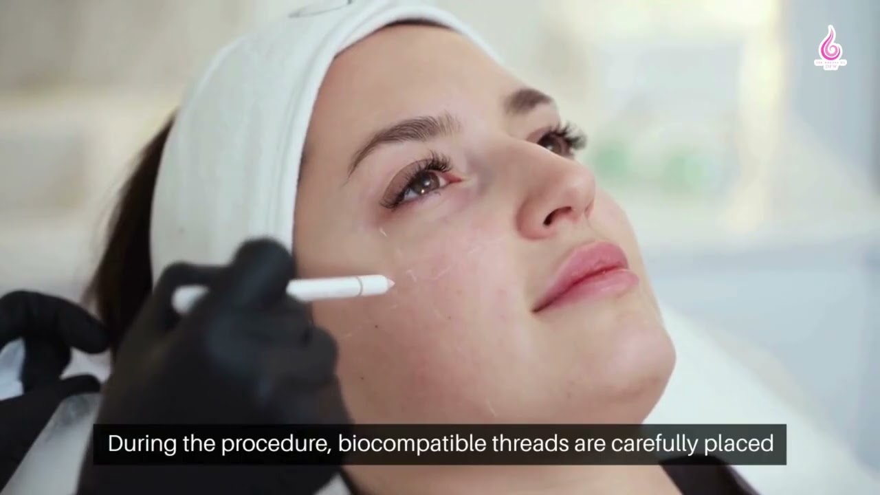 Why PDO Thread Lift in Grapevine/Southlake, TX Is Gaining Attention