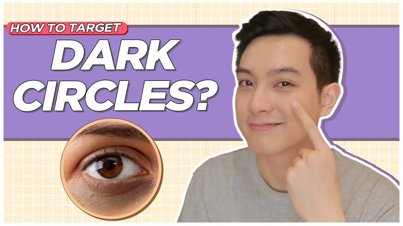 How to address DARK UNDEREYE CIRCLES? Causes + Products to Use! (Filipino) | Jan Angelo