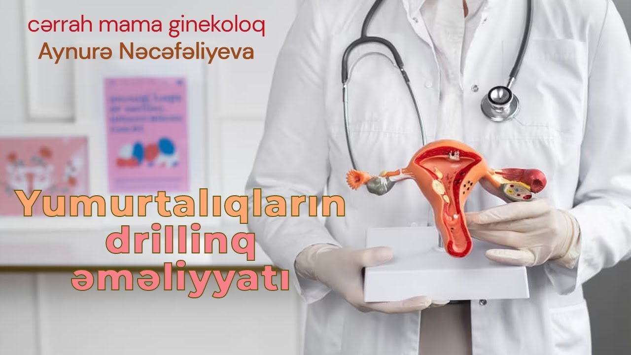 Yumurtalıqların drillinq əməliyyatı - ginekoloq uzman dr.Aynurə Nəcəfəliyeva