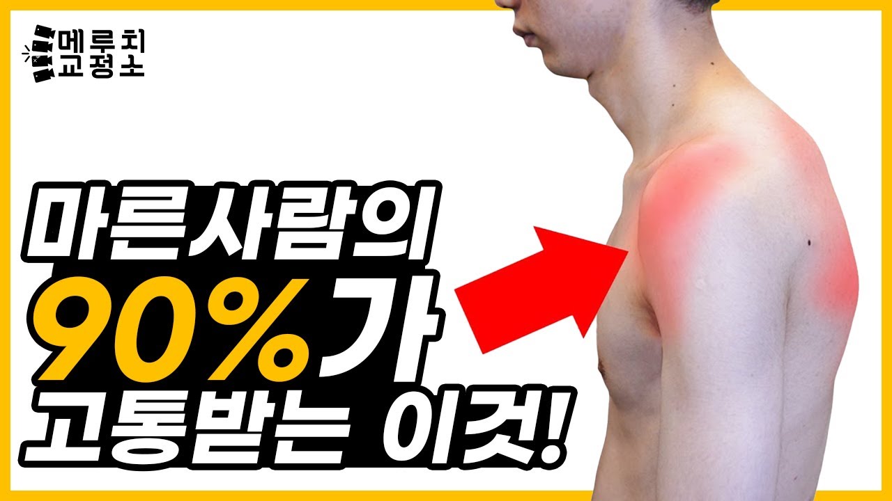 인생이 달라지는 굽은 어깨 교정법 ㅣ메루치교정소 (라운드숄더)