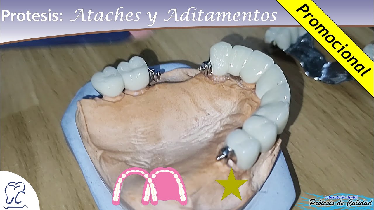 Prótesis: Ataches y Aditamentos 07