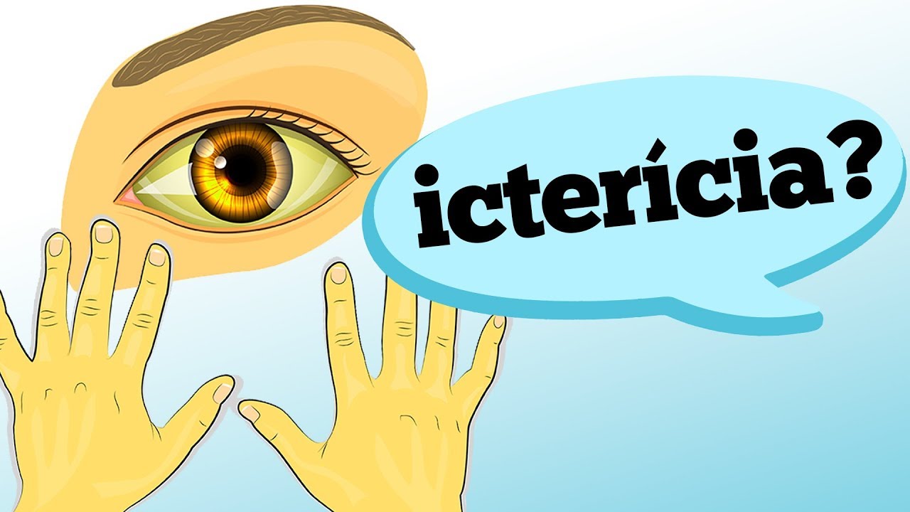 ICTER&Iacute;CIA EM ADULTOS: COMO RECONHECER?