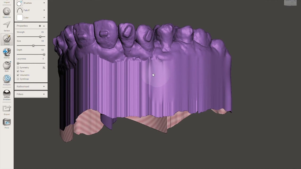 Meshmixer Tips + Tricks: Dental Model Design