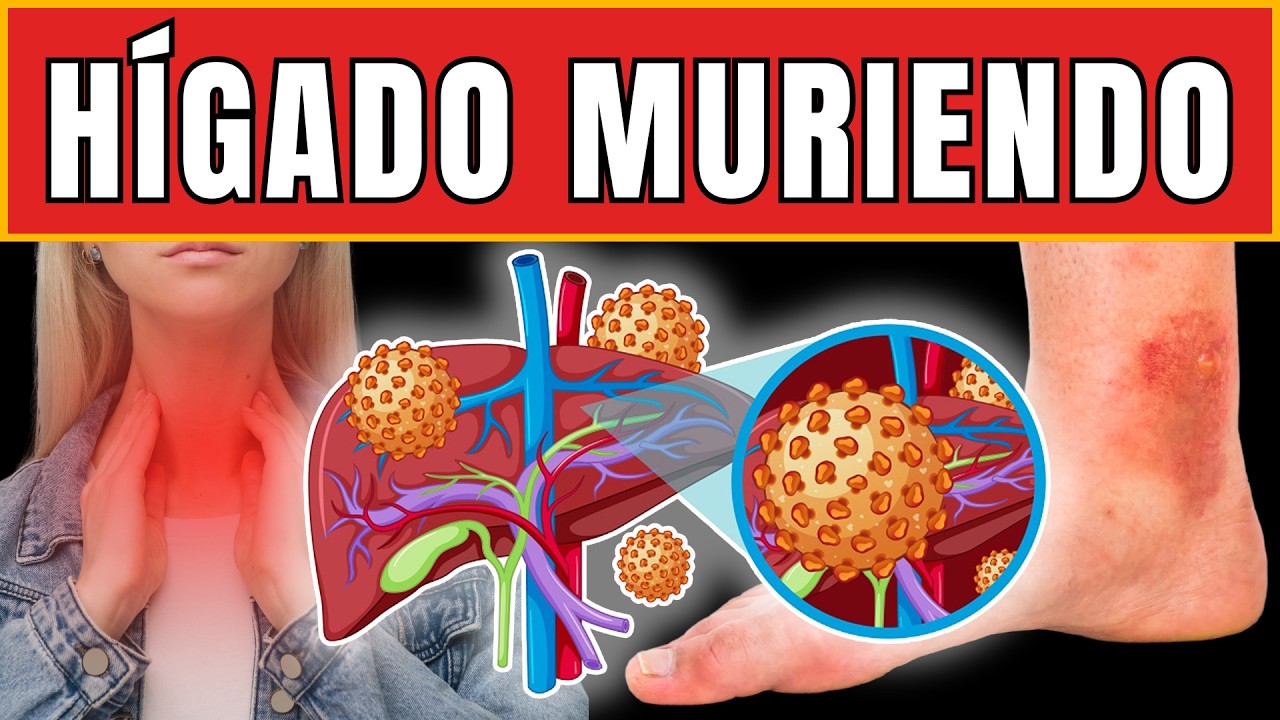 Hepatólogo Advierte: 7 Señales Mortales de que tu Hígado Está Dejando de Funcionar