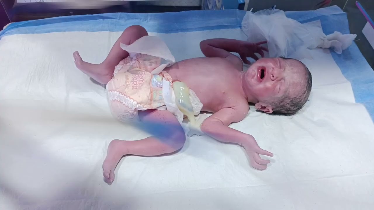 Life-Saving Steps for Critical Newborn | NICU Awareness Video #cutebabygirl #newborn #family 