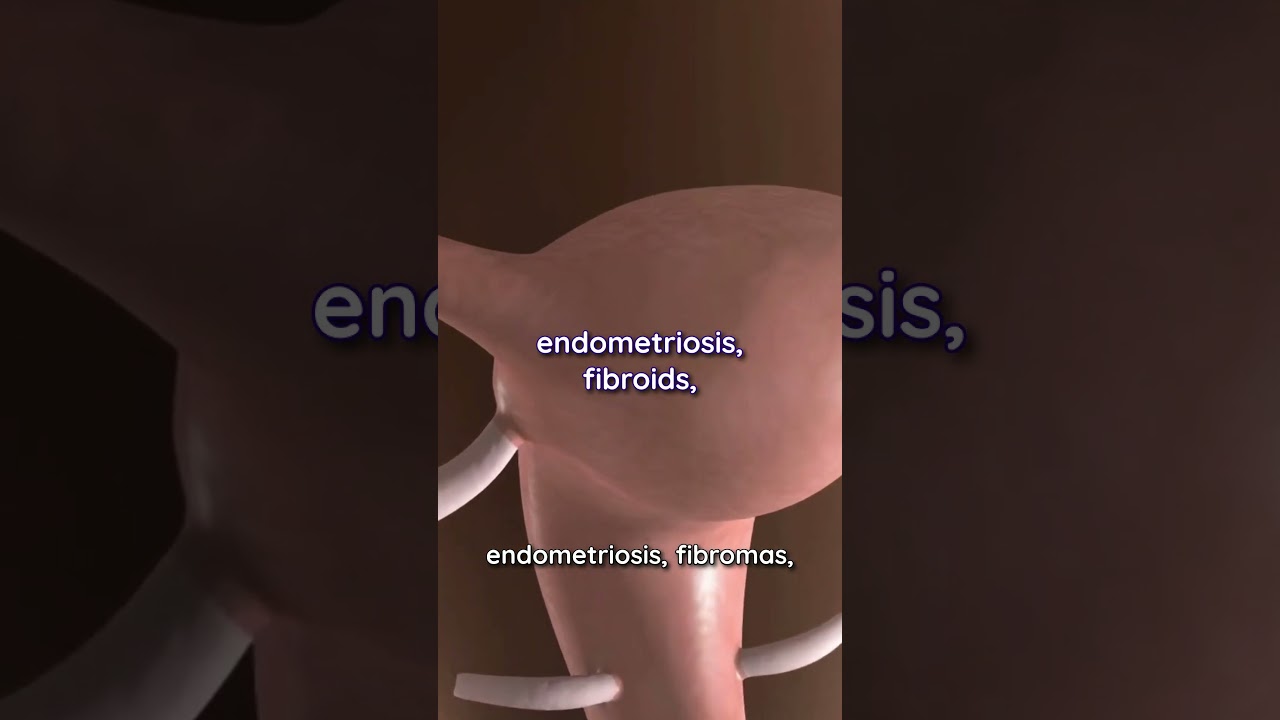Magnesium for Period Cramps #womenshealth #womenshormone #magnesium #shorts