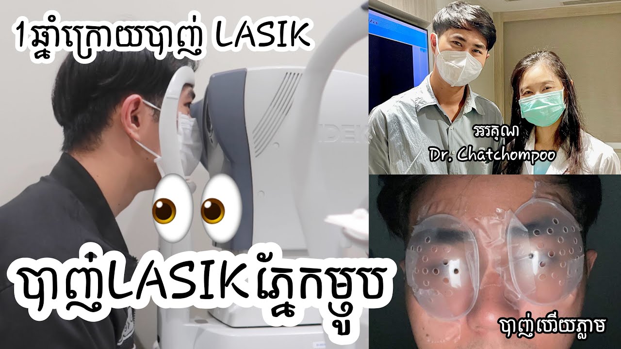 LASIK Review បាញ់ភ្នែកម្ញូបបាន1ឆ្នាំ 👀