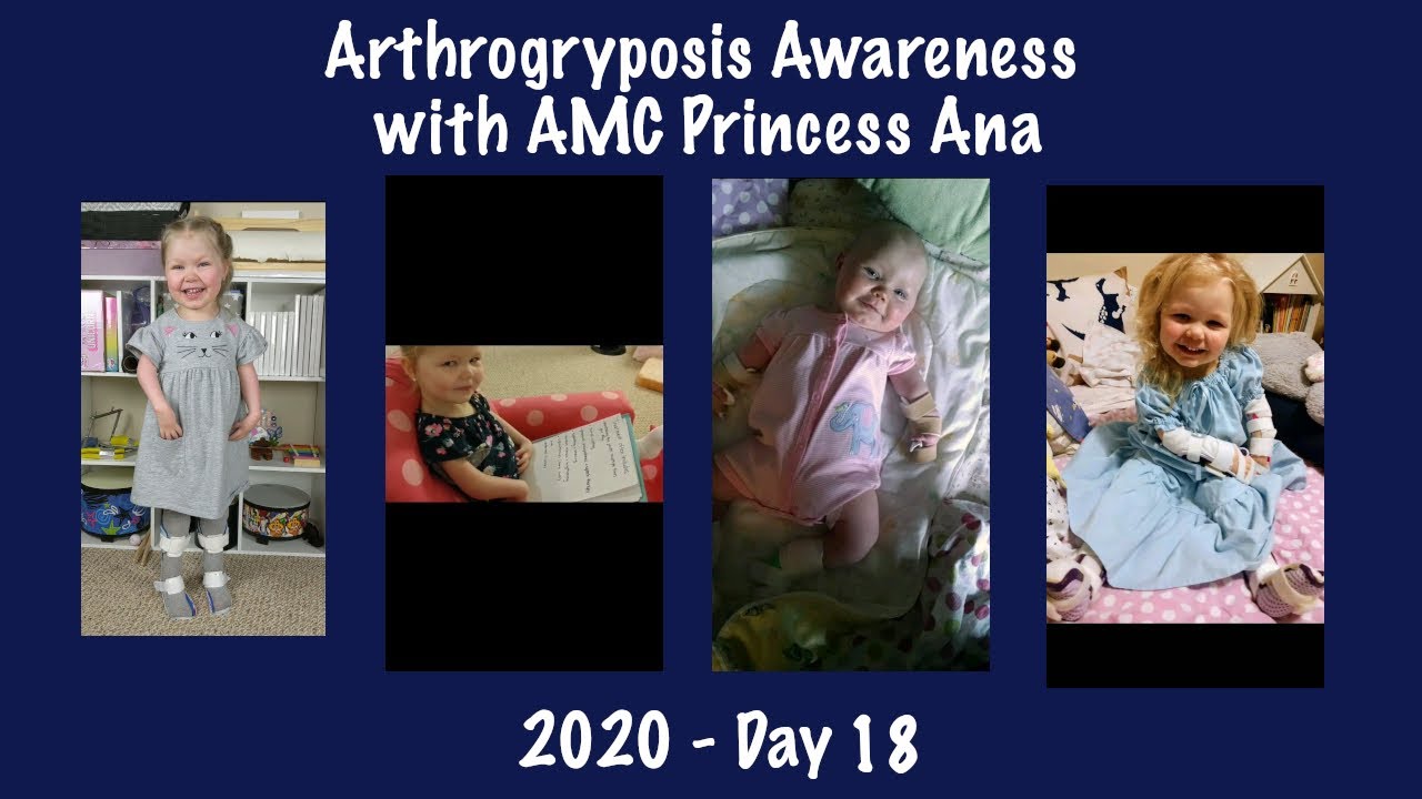 2020 Arthrogryposis Awareness with AMC Princess Ana - Day 18