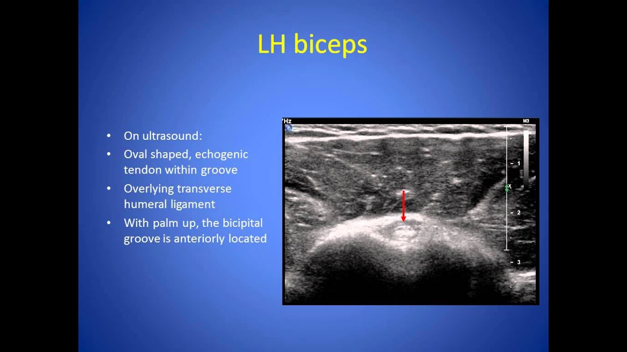 US Guided Shoulder Interventions - Campbell.mp4