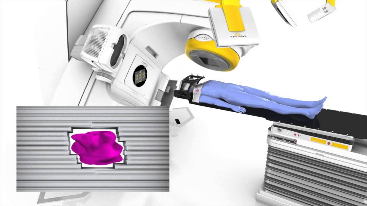 What is stereotactic radiosurgery and how does it work?
