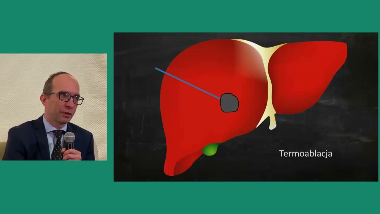 Radiologia interwencyjna &ndash; rola termoablacji w onkologii