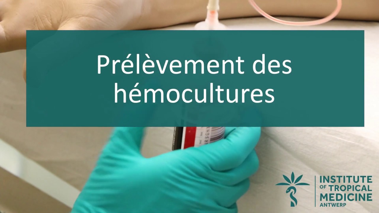 Prélèvement des hémocultures (V1)