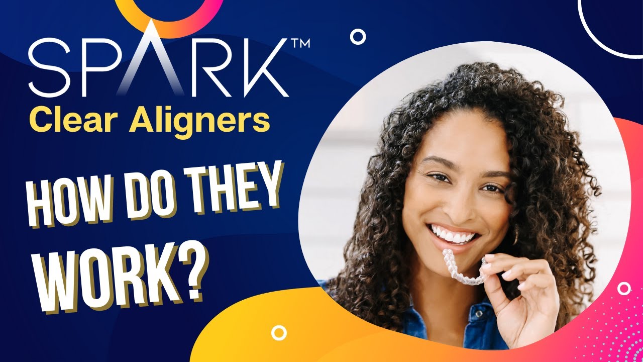 Spark Clear Aligners:  How Do They Work?
