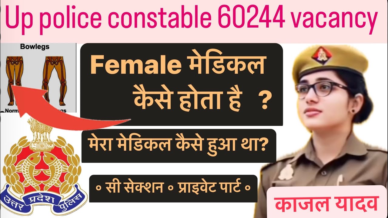 उत्तर प्रदेश पुलिस  कांस्टेबल में फीमेल मेडिकल कैसे होता है ? मेरा मेडिकल कैसे हुआ था? … #upppolice
