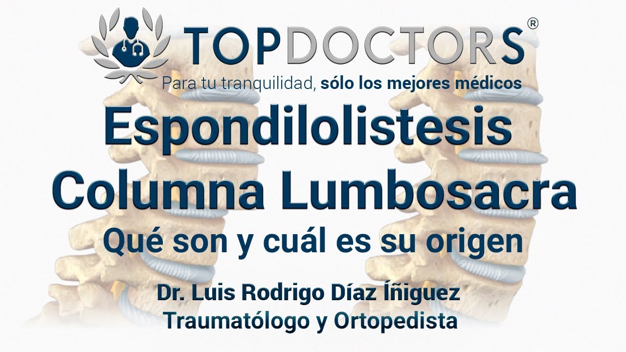 &iquest;Qu&eacute; es la espondilolistesis columna lumbosacra? Conoce los detalles