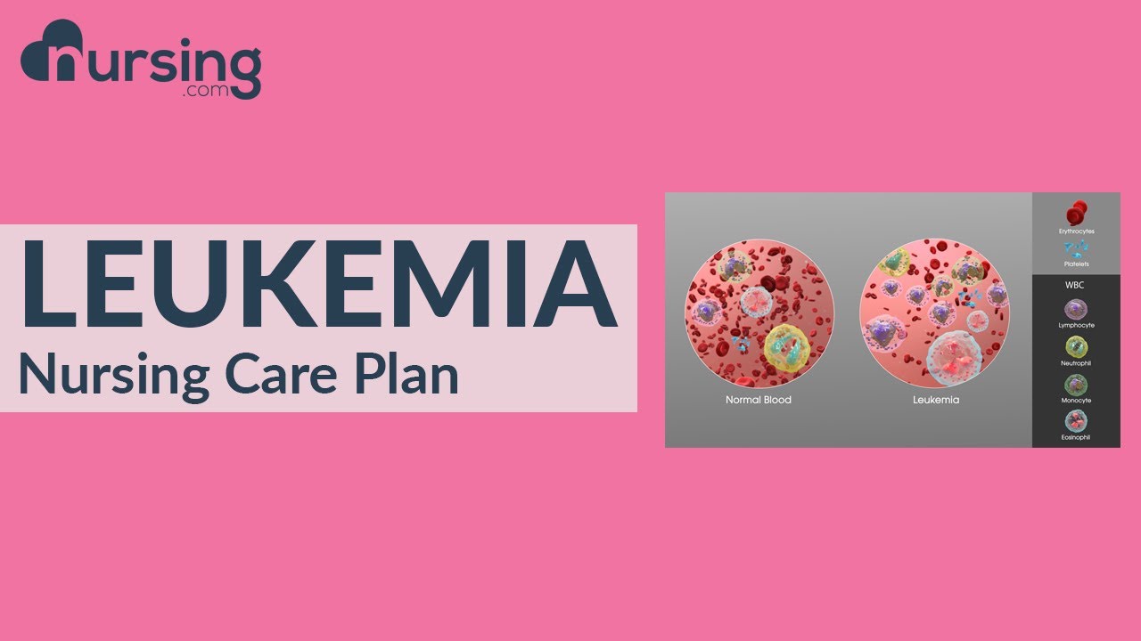 nursing care plan for Leukemia (Nursing Care Plan Tutorial)