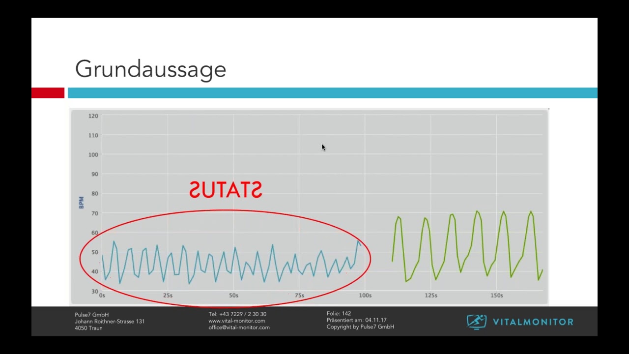 Vitalmonitor Webinar - Kalibration