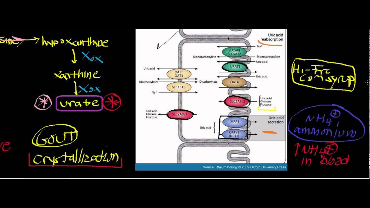 Biochemistry | Urate Oxidase and Urate [Part 2/3] - Physiology, Gout, & Kidney Stones