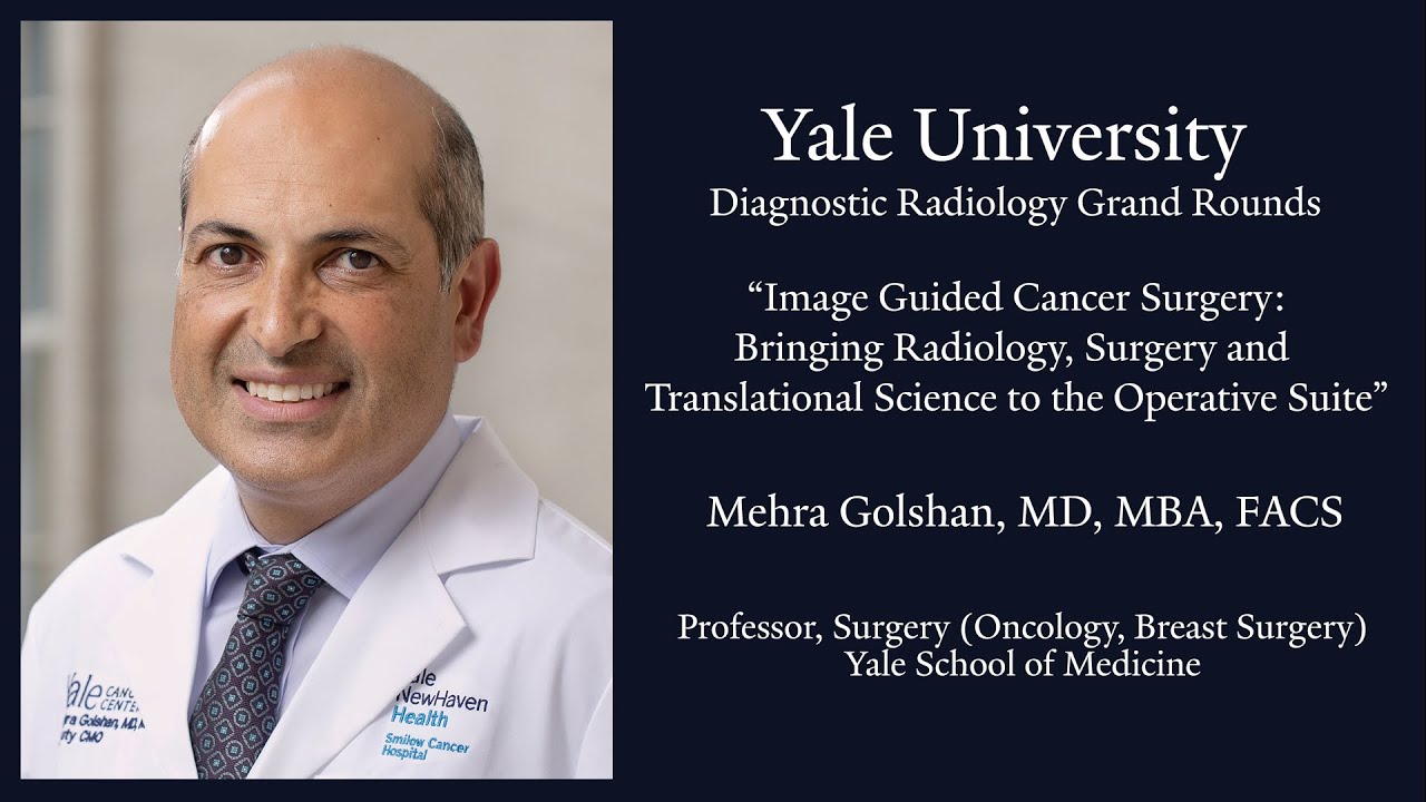 Image Guided Cancer Surgery: Bringing Radiology, Surgery & Translational Science to Operative Suite