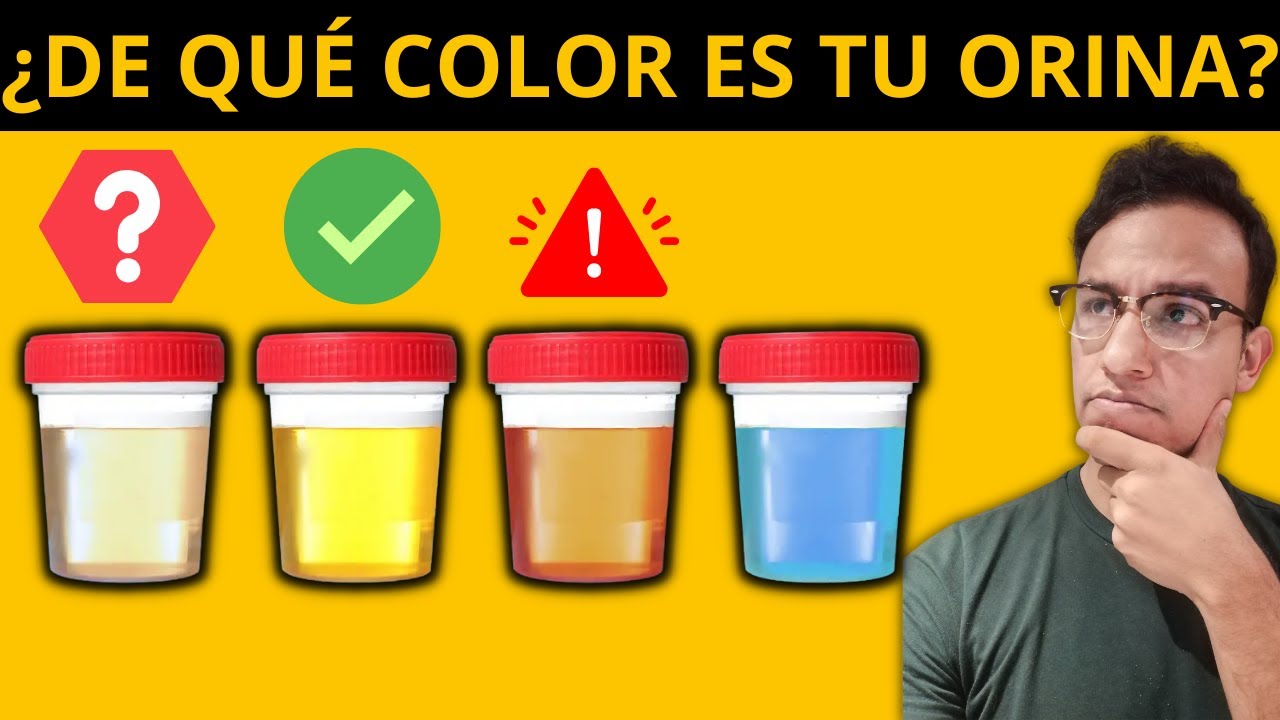 ¿QUÉ SIGNIFICA EL COLOR DE TU ORINA? - Datos CLAVE, ESPUMA, COLOR, OLOR