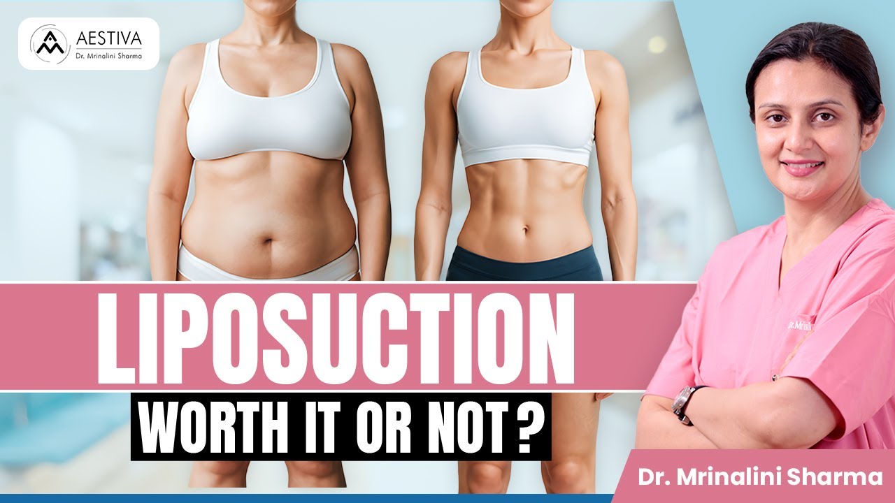 Liposuction- Is It the Right Choice for You? | Liposuction Surgery in India | Aestiva Clinic