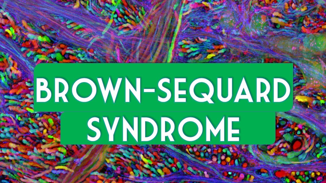 Brown-Séquard syndrome