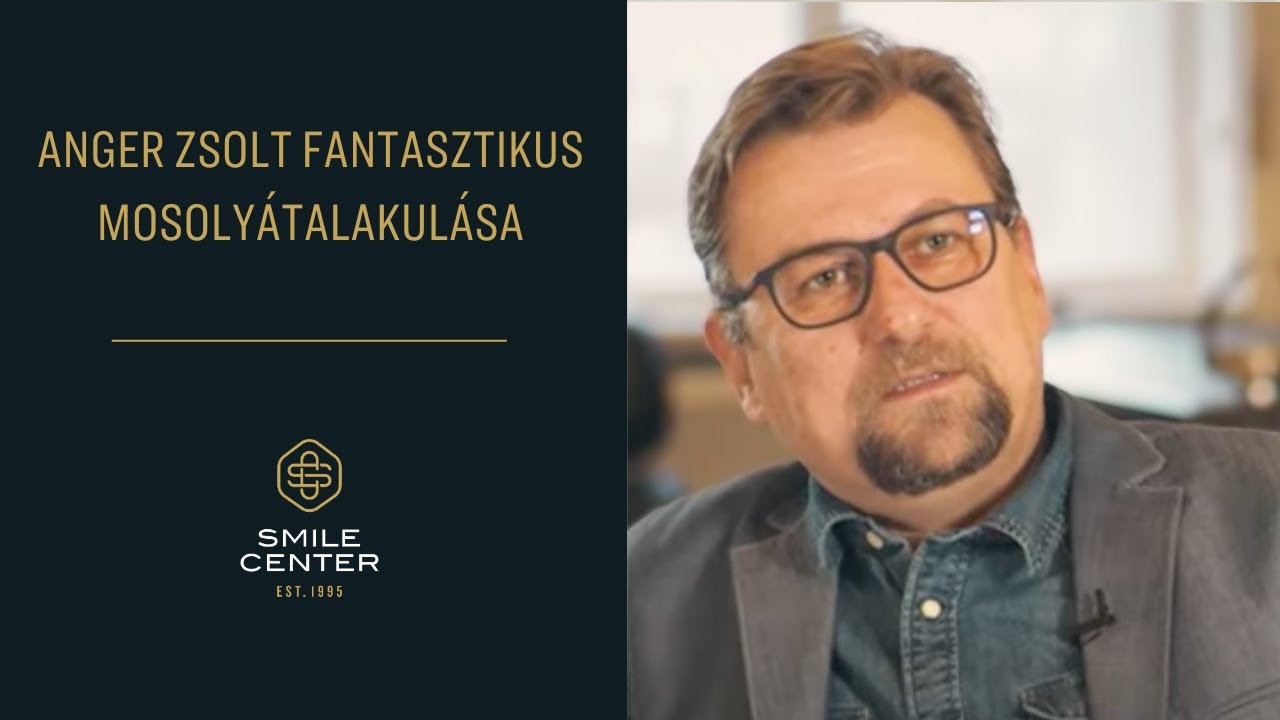 Anger Zsolt fantasztikus mosoly&aacute;talakul&aacute;sa is a SmileCenter rendelőj&eacute;ben t&ouml;rt&eacute;nt. ✨