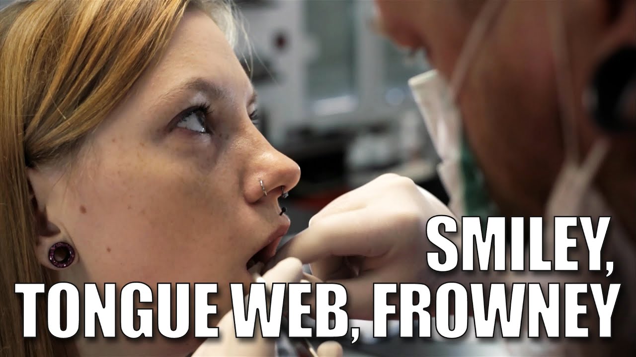 SMILEY, TONGUE WEB, FROWNEY - Przekłucie wędzidełka ✪ Bezpieczny piercing ✪