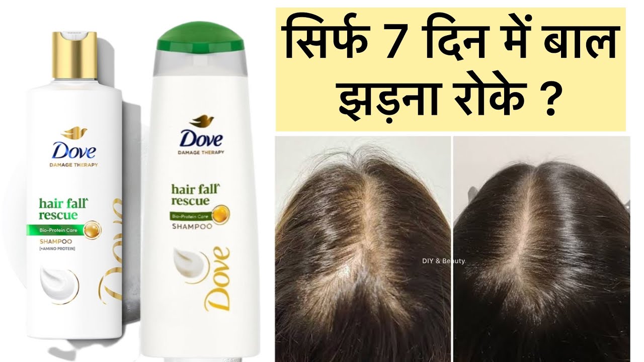Full Review | Dove Hairfall Rescue |Watch till the end before using it 