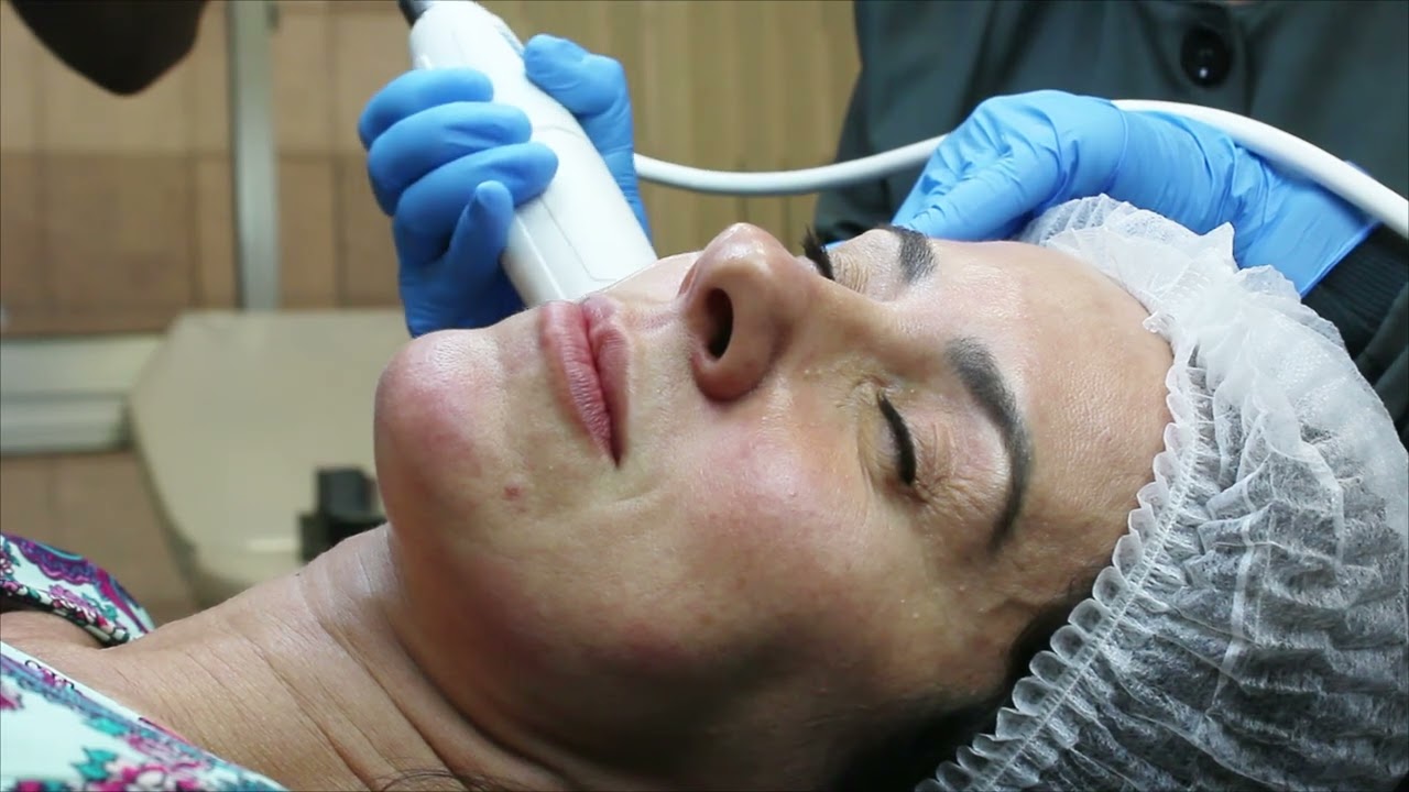ULTRASSOM MICROFOCADO - VISALIFTNG