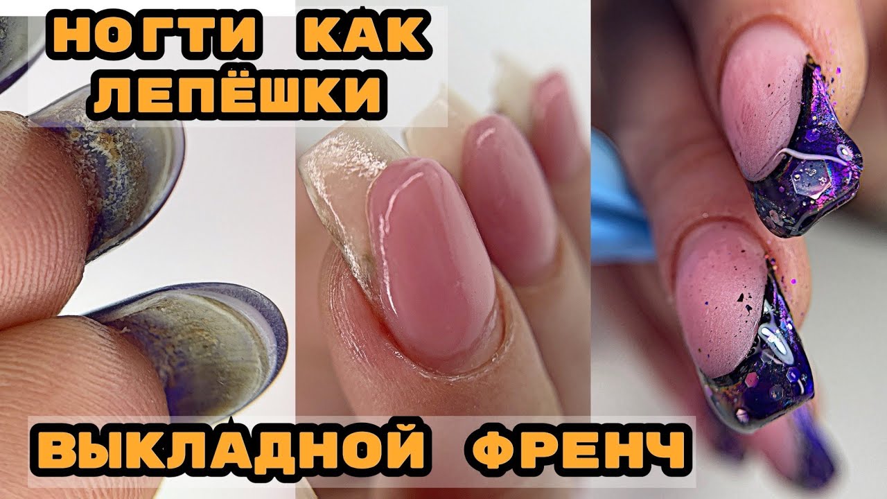НОГТИ ЛЕПЕХИ 😅 Выкладной френч на ногтях 💅 Френч пошагово 💅 Как поднять клюющий ноготь