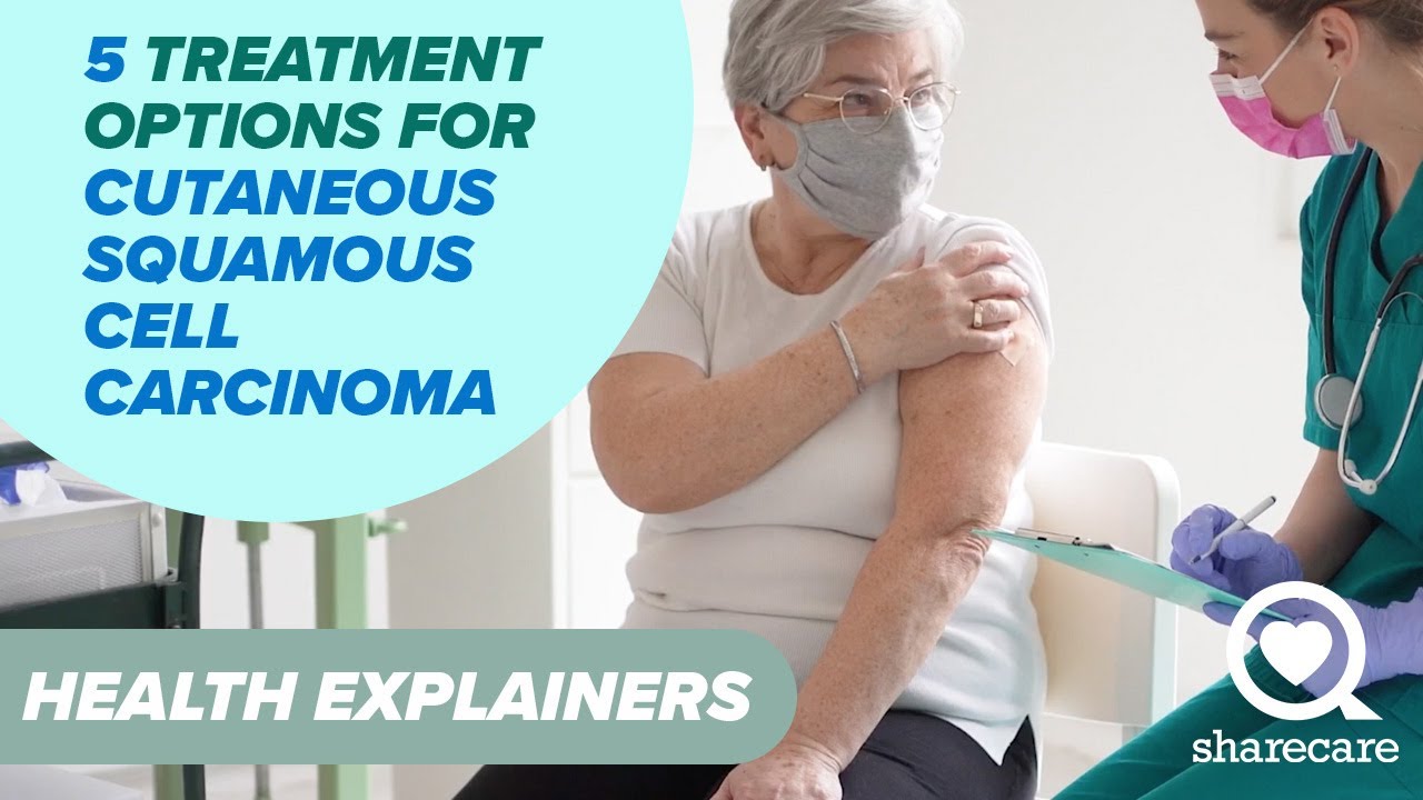 5 Treatment Options for Cutaneous Squamous Cell Carcinoma | Health Explainers | Sharecare