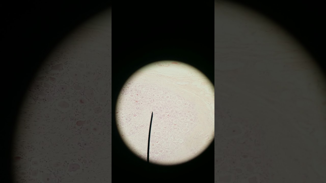 Multipolar vs. Pseudounipolar vs. Bipolar neurons histology