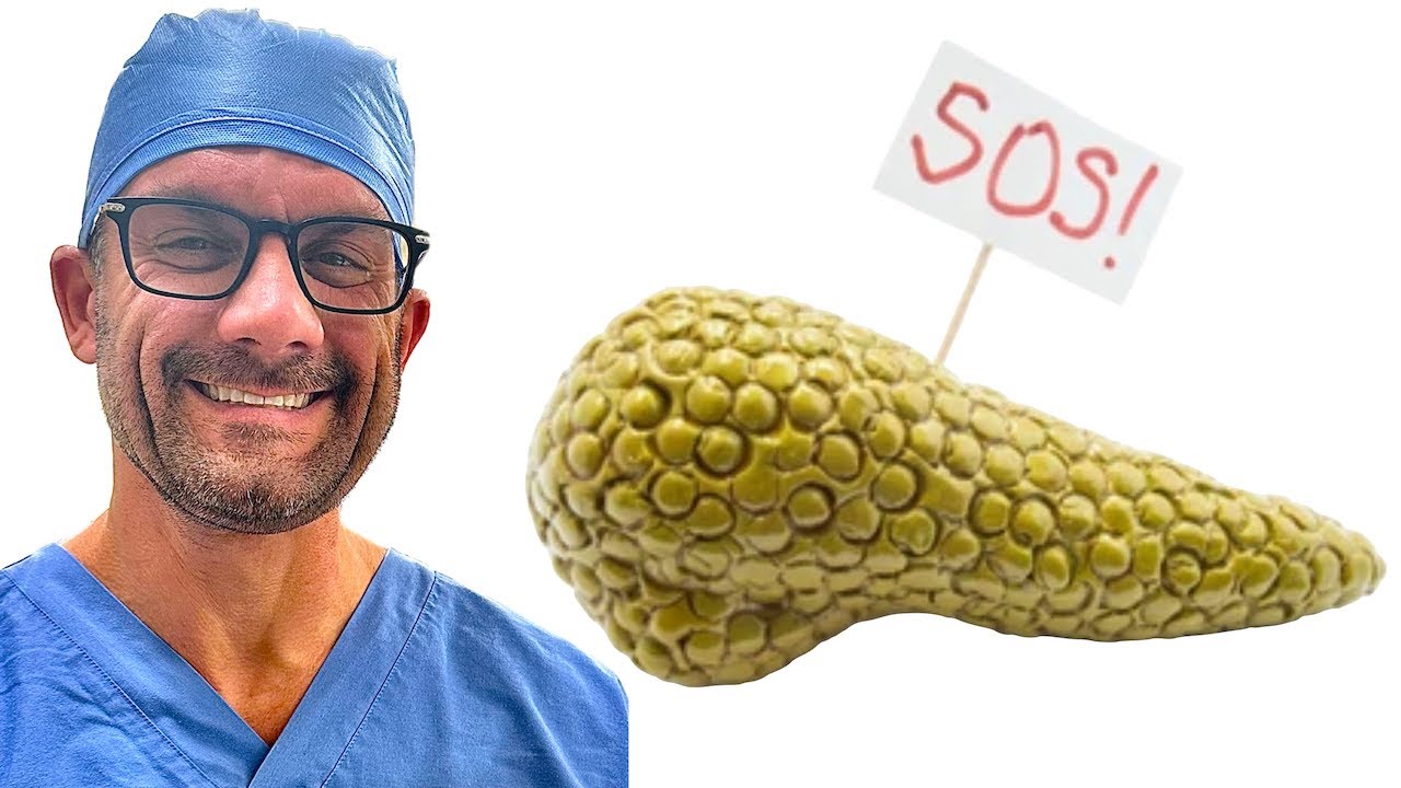 How to Treat Acute Pancreatitis