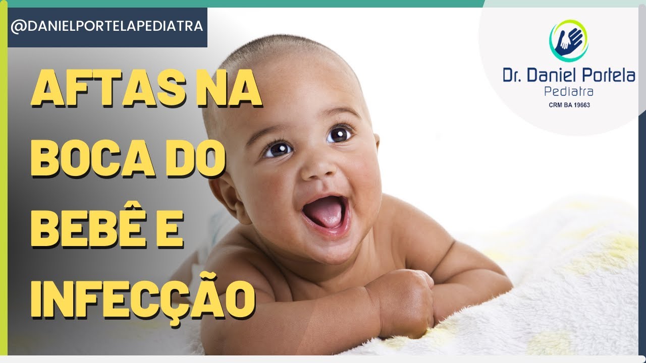 Aftas na boca do bebê e infecção pelo herpes vírus (estomatite herpética)