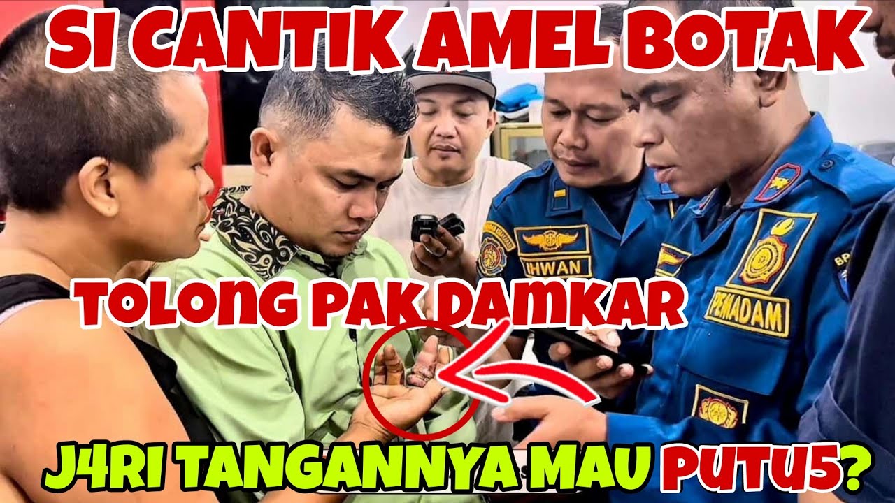 ODGJ SI CANTIK AMEL BOTAK JARI TANGAN NYA MAU PUTU$⁉️ TOLOOOONG PAK DAMKAR 