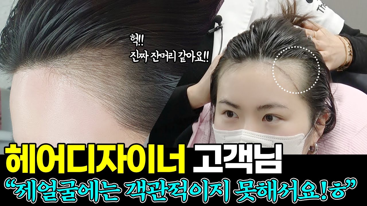 [헤어라인반영구] M자이마 메이크업으로는 안가려져서 필러 고민 하다가..이걸로 선택했어요!탈모고민 끝