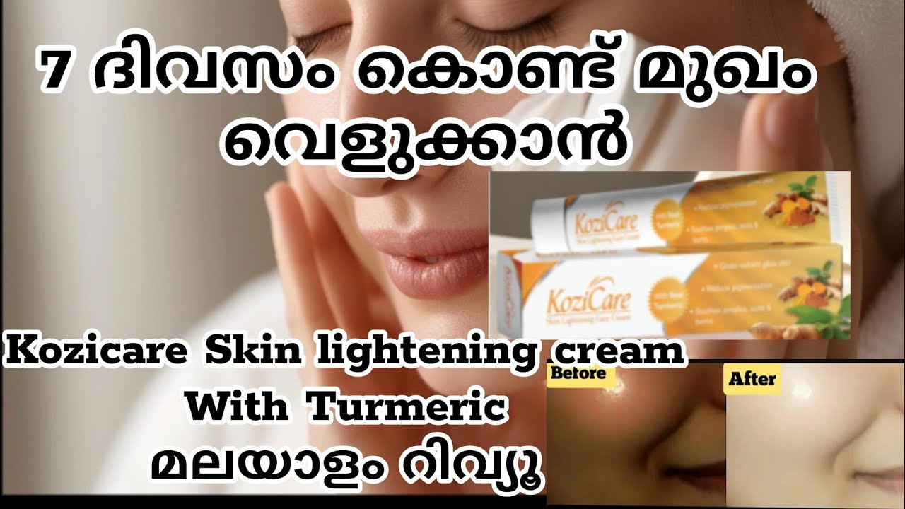 kozicare kojic acid turmeric cream Malayalam review  #beautyproductreviews #skincare #skinwhitening
