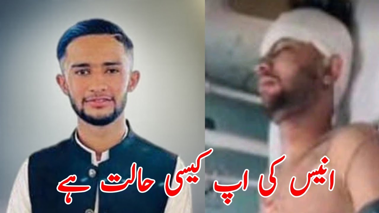 🚨 YouTuber Anis’s Terrible Accident! 😢 What’s His Condition Now? Full Story Revealed!